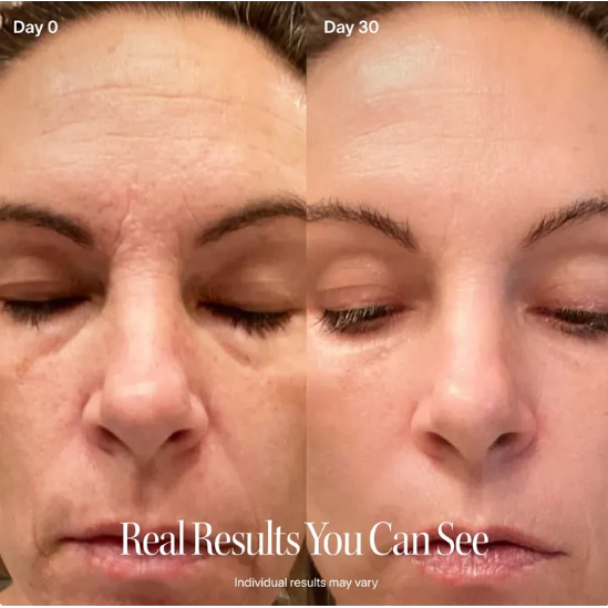LumaLift™ Red Light Therapy Wand