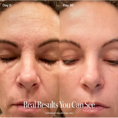 LumaLift™ Red Light Therapy Wand