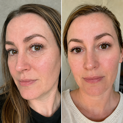 ReLumen® 2-in-1 Red Light Therapy + EMS for Thin, Crepey Under-Eyes