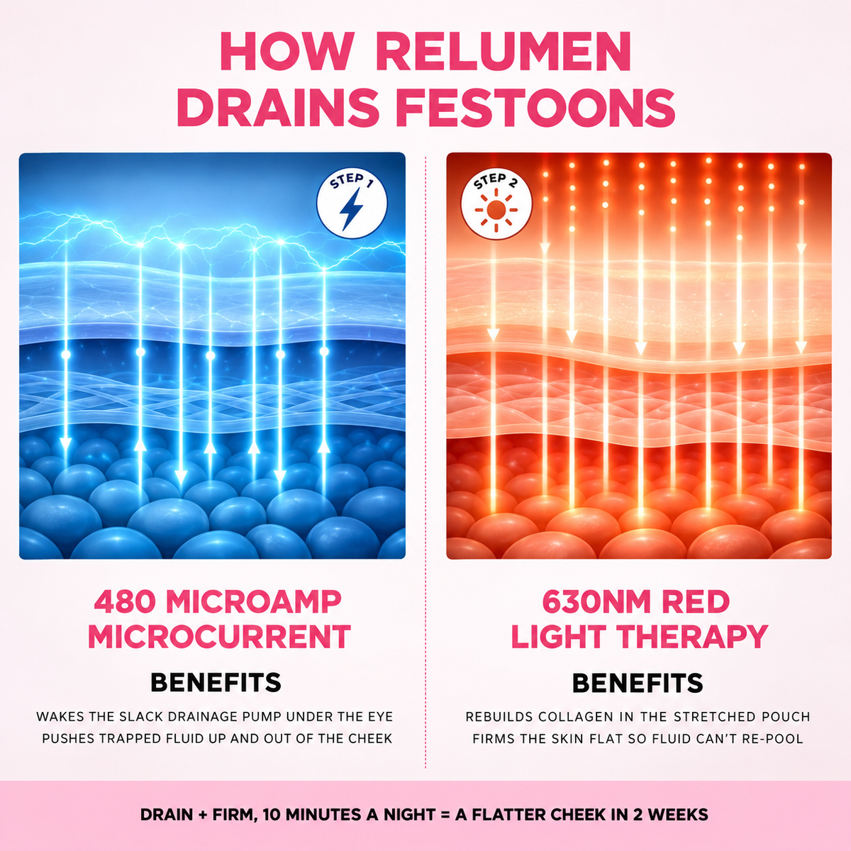 ReLumen® Triple Drainage System