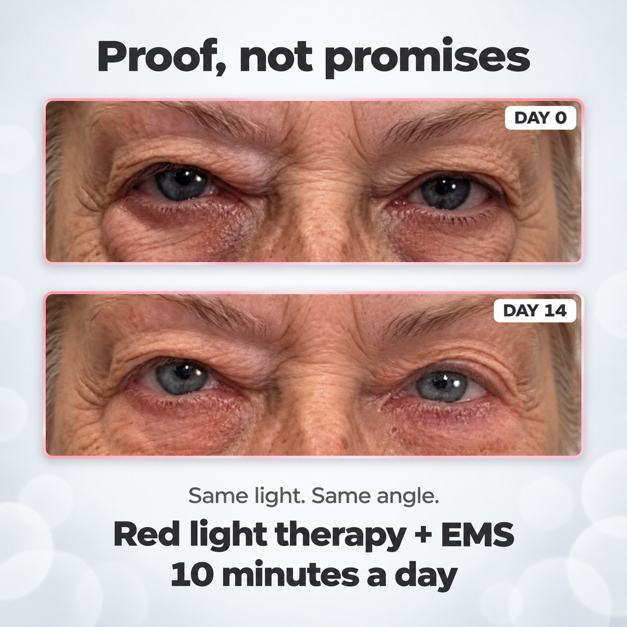 ReLumen® 2-in-1 Red Light Therapy + EMS To Erase Eye Bags