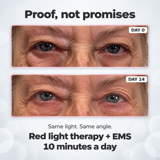ReLumen® 2-in-1 Red Light Therapy + EMS To Erase Eye Bags