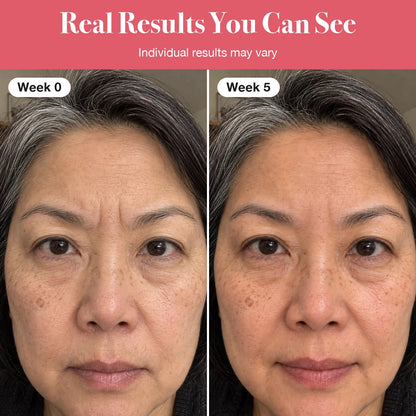 LumaLift™ Red Light Therapy Wand To Soften Frown Lines