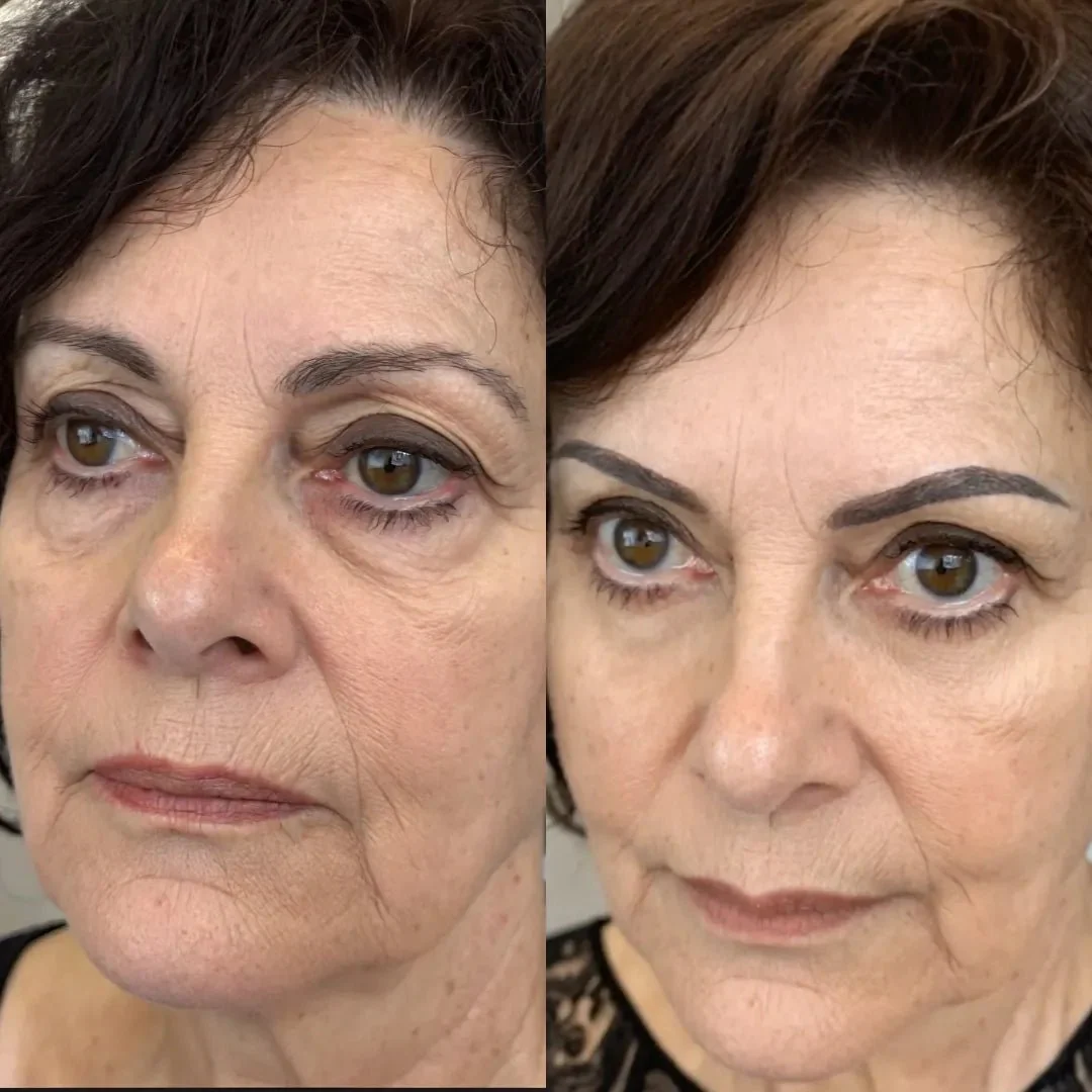 ReLumen® 2-in-1 Red Light Therapy + EMS To Erase Eye Bags