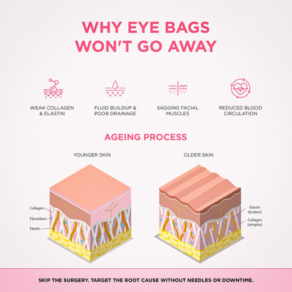 ReLumen® 2-in-1 Red Light Therapy + EMS To Erase Eye Bags