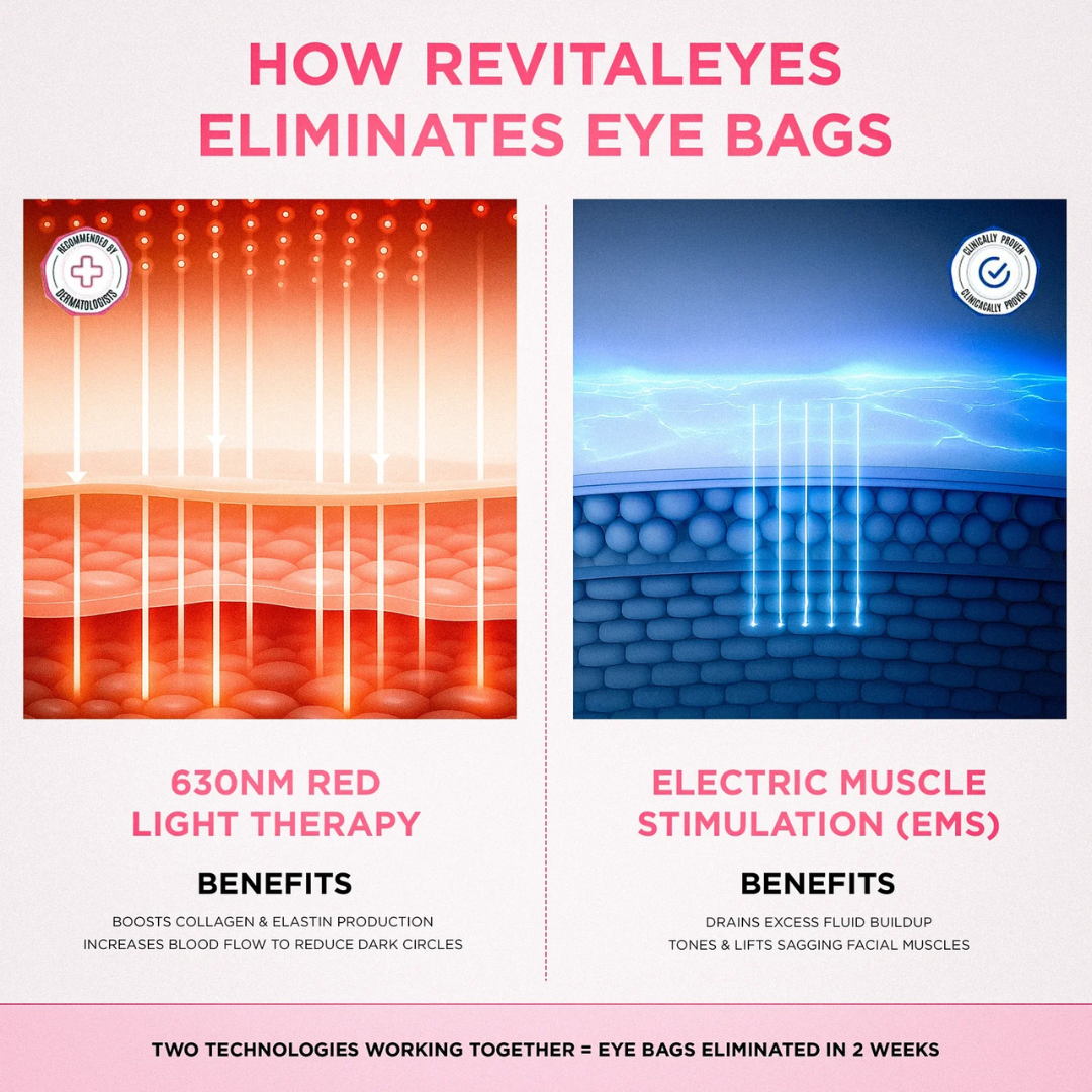 ReLumen® 2-in-1 Red Light Therapy + EMS To Erase Eye Bags