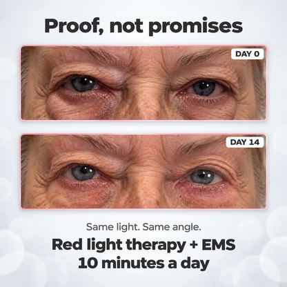 ReLumen® 2-in-1 Red Light Therapy + EMS To Erase Eye Bags